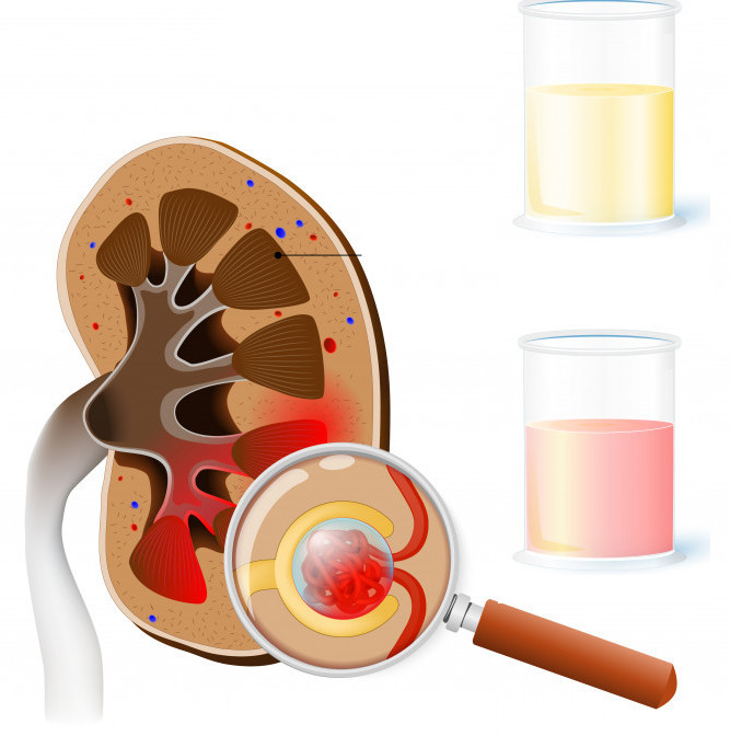 Расчёт скорости клубочковой фильтрации / СКФ – ByMed
